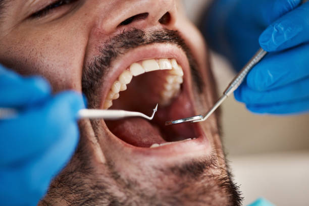 Best Walk-In Emergency Dentist in Solomon, KS